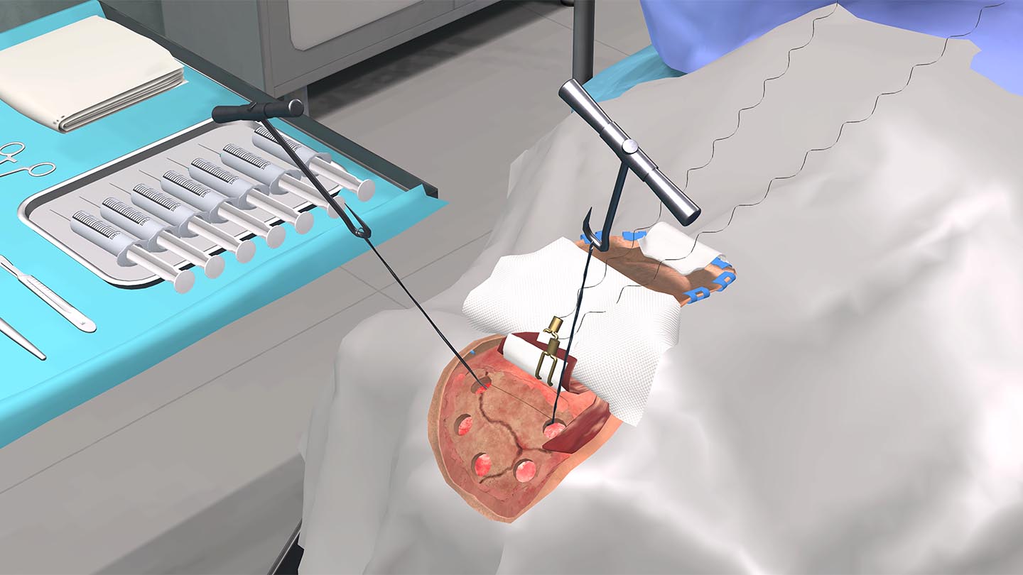 Образовательный комплекс «Виртуальная хирургическая операционная: Декомпрессионная краниотомия»