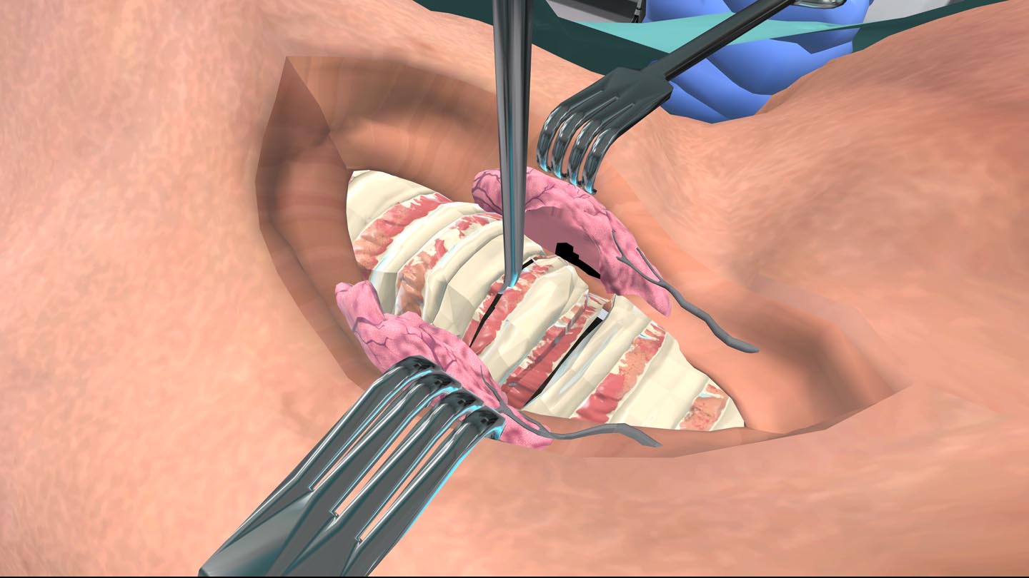 Образовательный комплекс «Виртуальная хирургическая операционная: Трахеостомия»