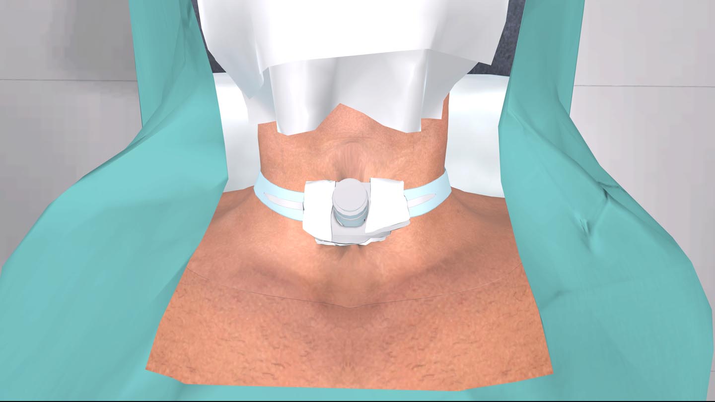 Образовательный комплекс «Виртуальная хирургическая операционная: Трахеостомия»