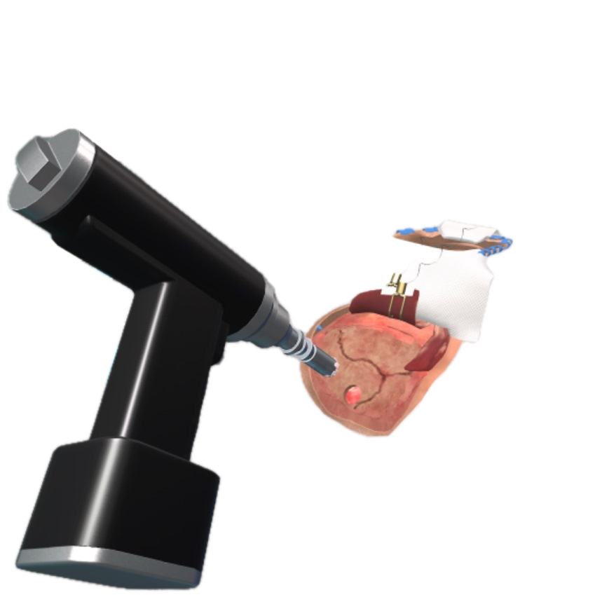 Образовательный комплекс «Виртуальная хирургическая операционная: Декомпрессионная краниотомия»